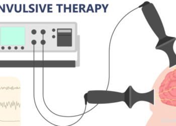 Electroconvulsive Therapy